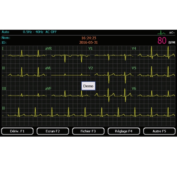 Electrocardiographe Spengler Cardiomate 6